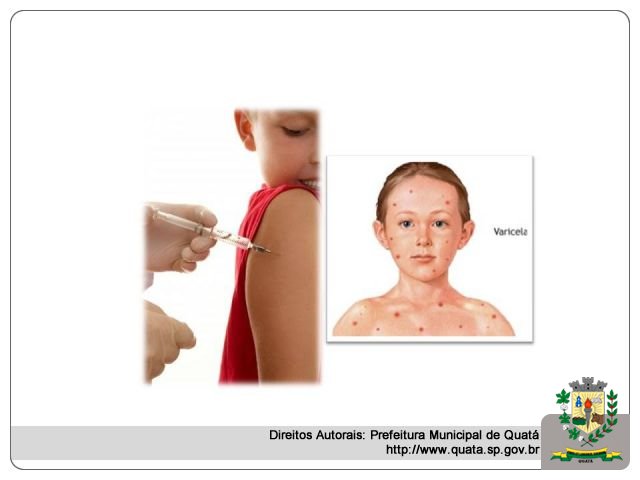 Notícia Crianças de Creche Municipal recebem dose de vacina contra catapora